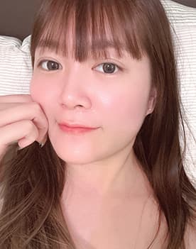 案例1術後